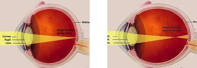 视网膜光镜结构图图片