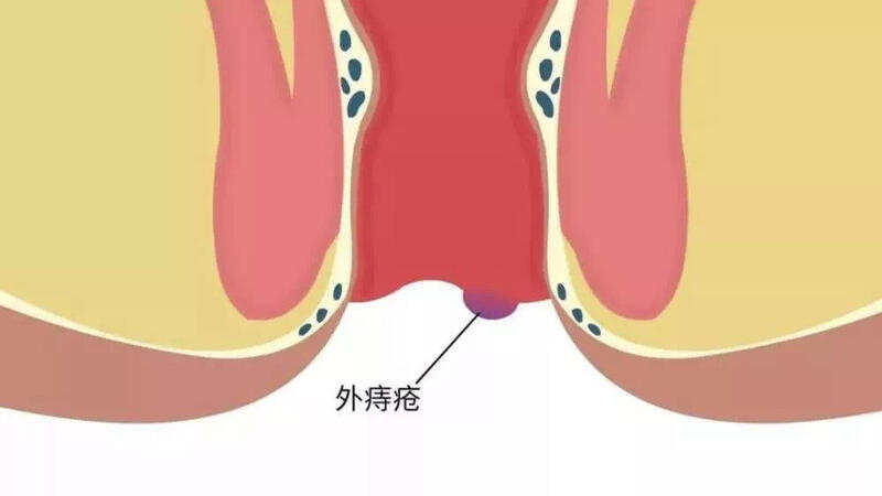 圖文圖片