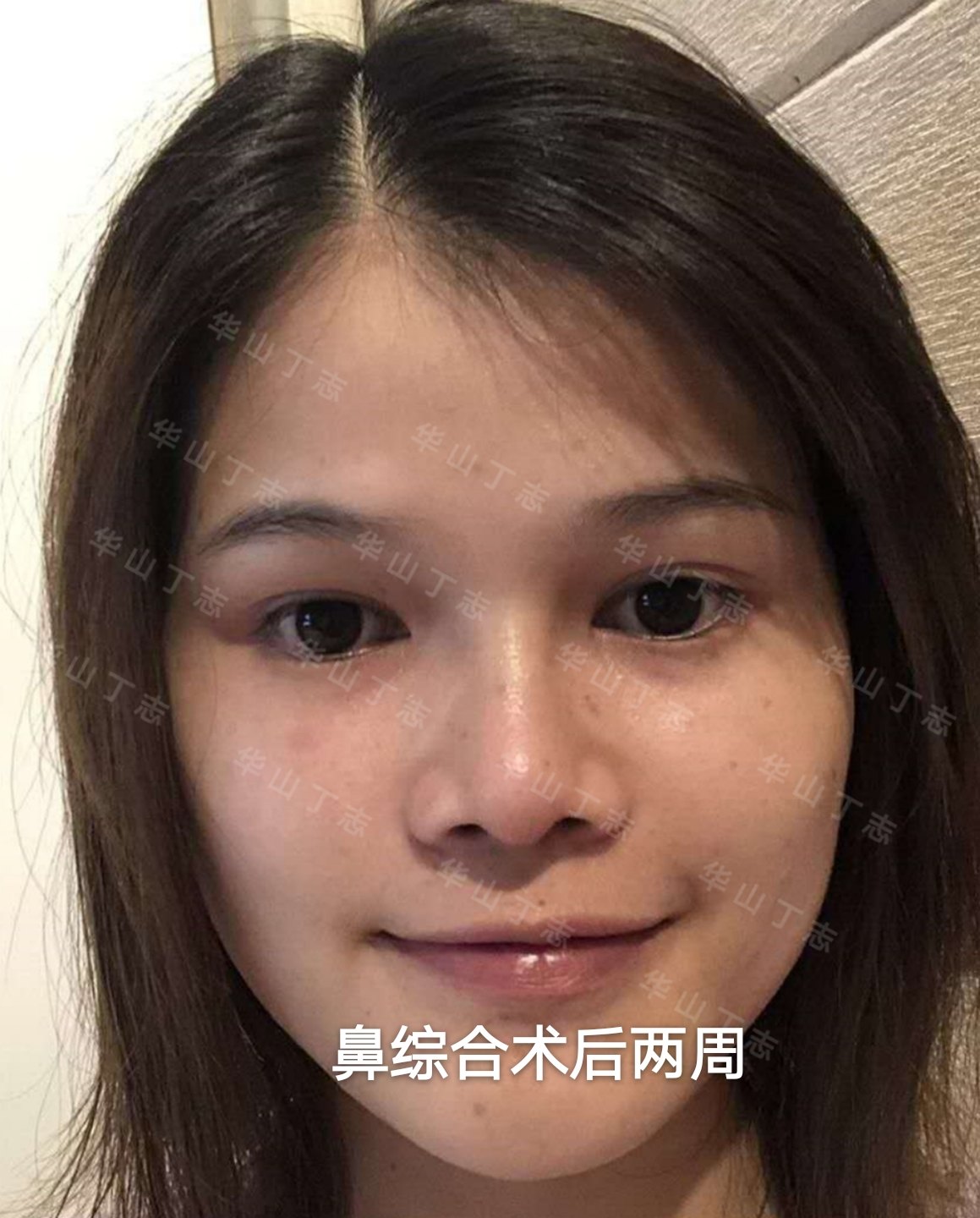 暂无