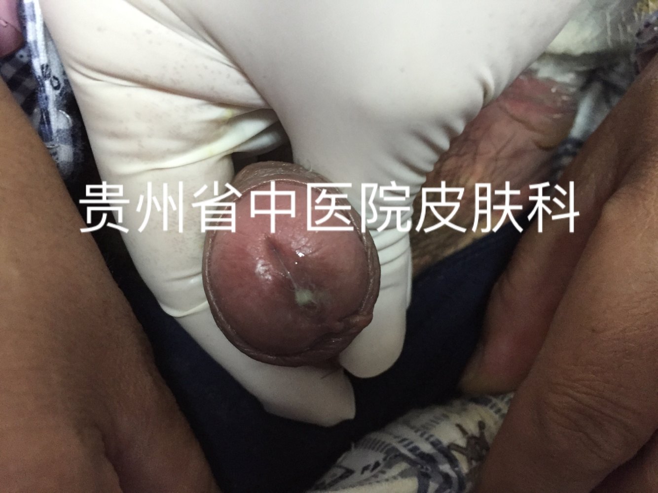 暂无