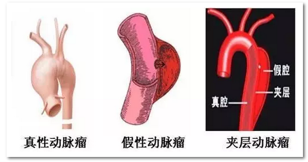 1493087885853595.png 图片.png