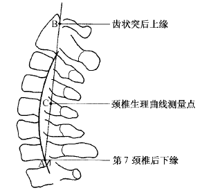 颈椎的生理曲度是什么