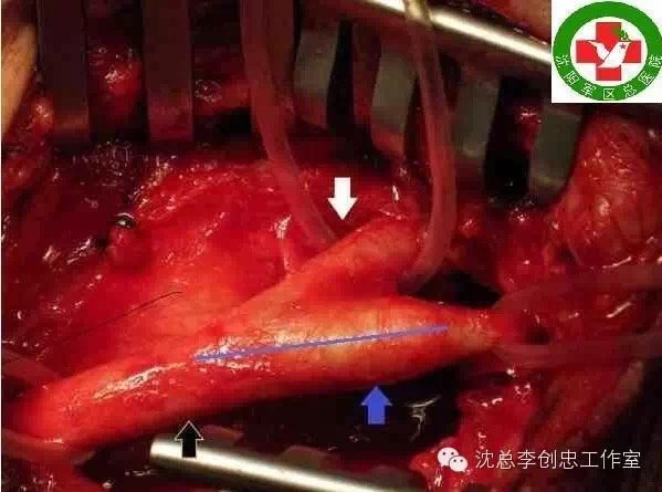 暂无