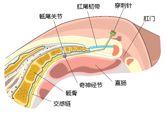 臀裂在哪图片图片