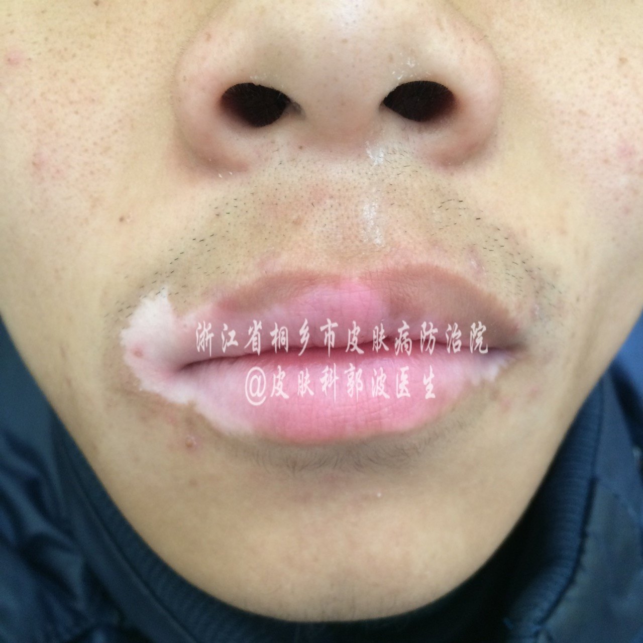 1487728411.png