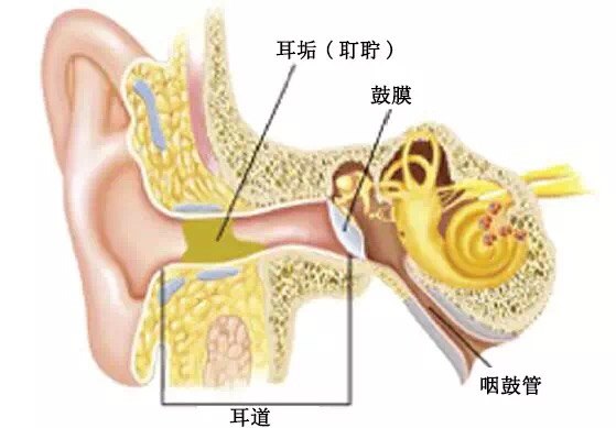 关于耵聍栓塞这些不可不知