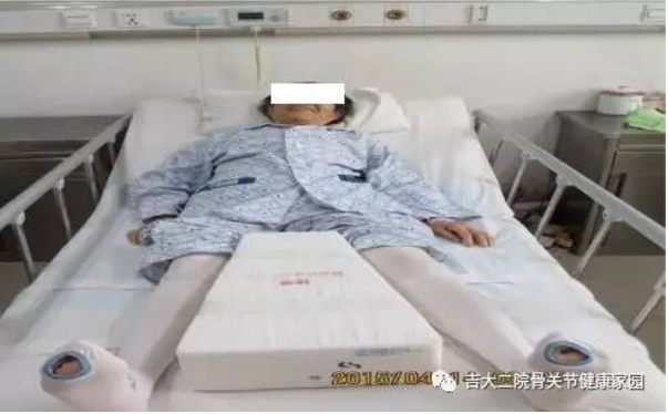 髋关节术后患者正确体位及梯形垫的使用 - 好大夫在线