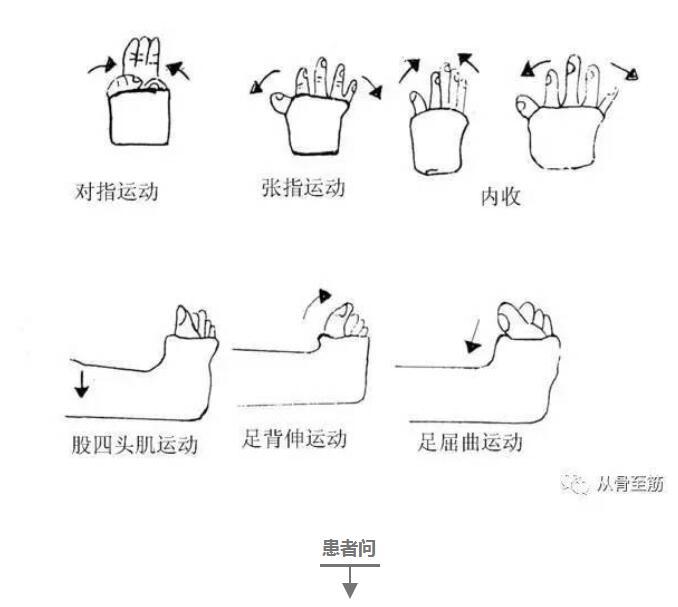 石膏固定图解图片