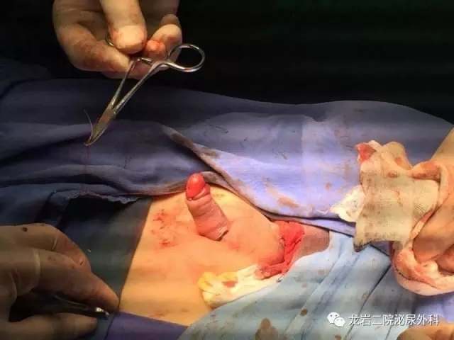 塑男性雄风,做男人"挺"好! - 好大夫在线