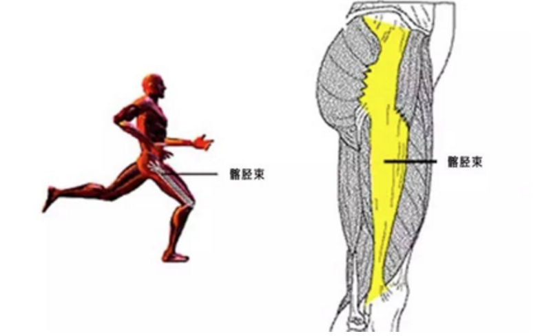 大腿麻筋位置图图片