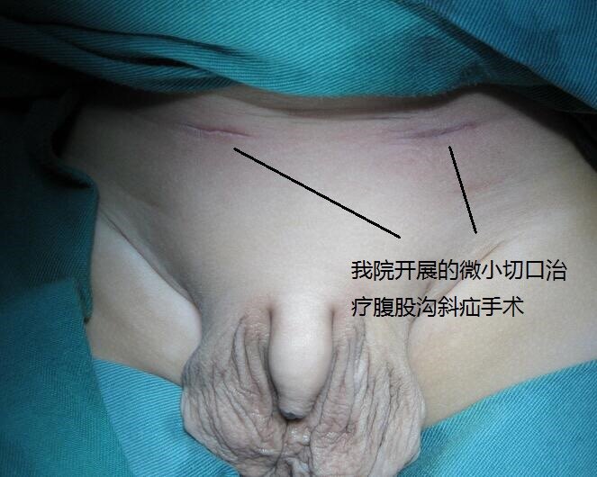 暂无