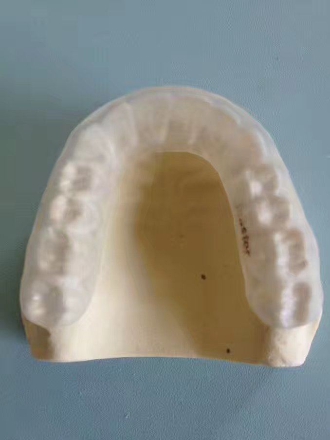 牙齿磨牙后垫图示图片