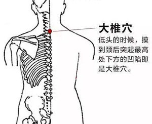 颈第七椎的准确位置图图片