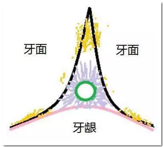 牙周之光,为牙线伴舞的数分钟(线圈法牙线使用方法介绍)