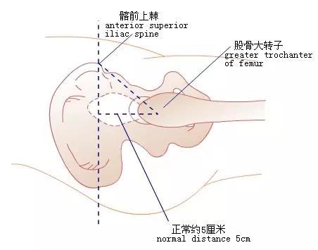 bryant三角底边缩短图片