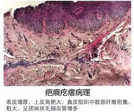 1505040764300741.png 图片.png