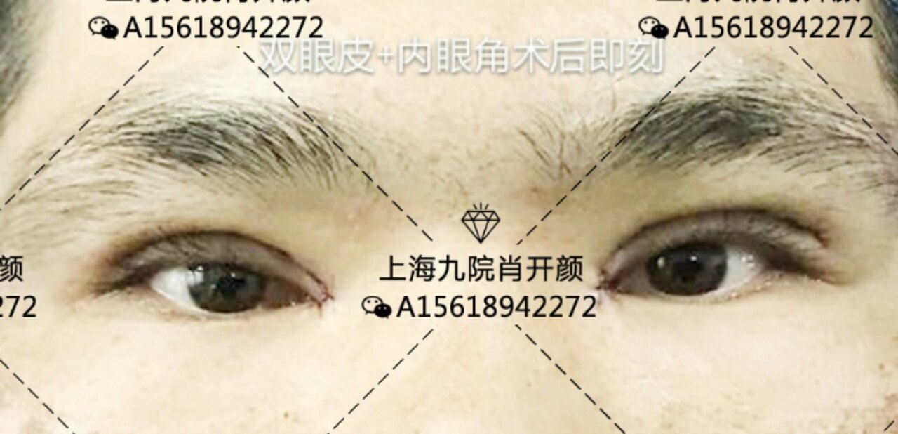 暂无
