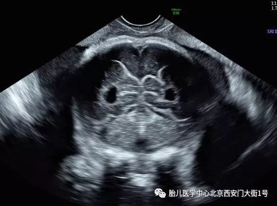 暂无