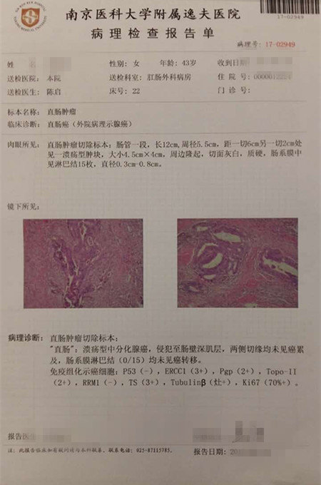 低位直肠癌改良isr手术 - 好大夫在线