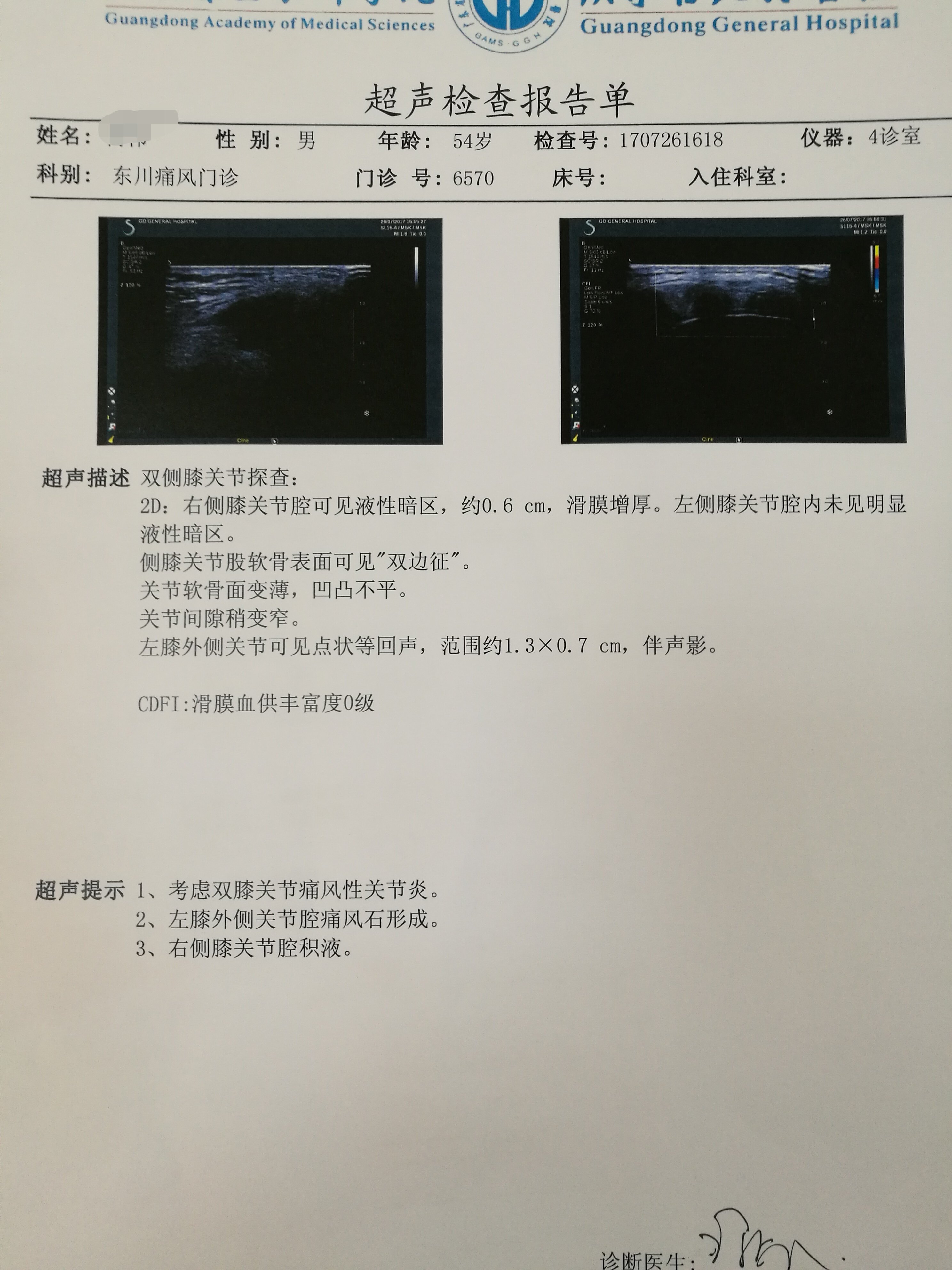 痛风肾超声图片图片