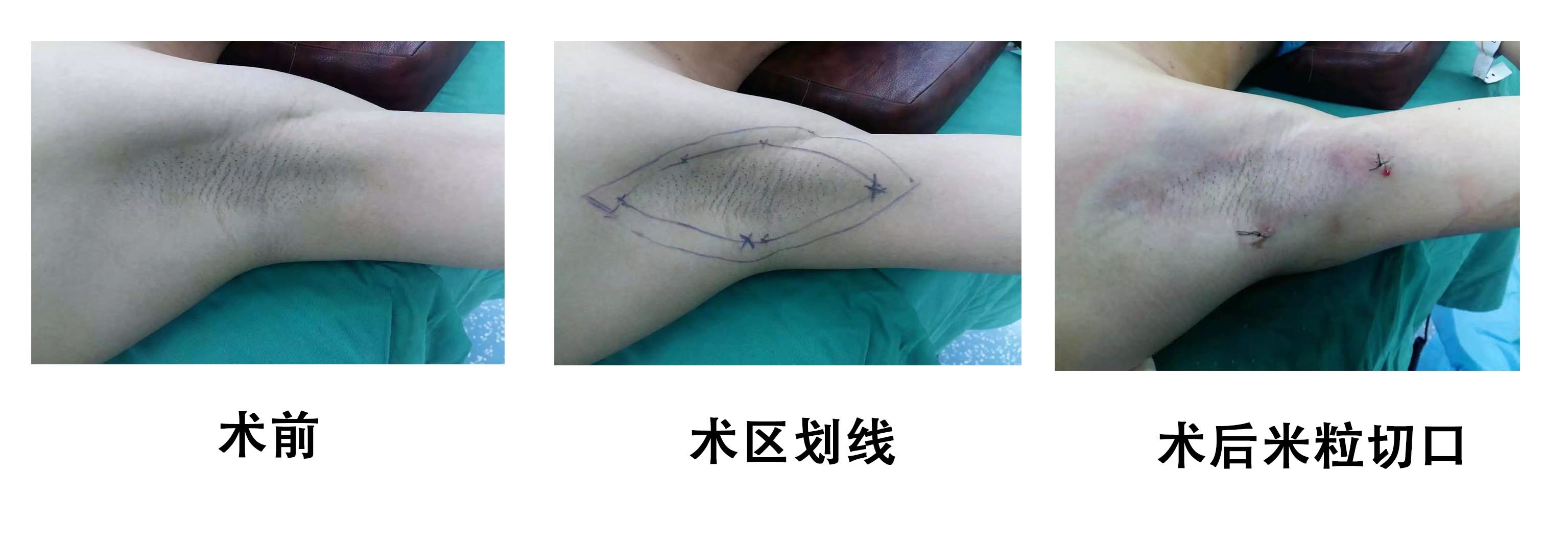 南京腋秀医疗:打造健康体态的新标杆
