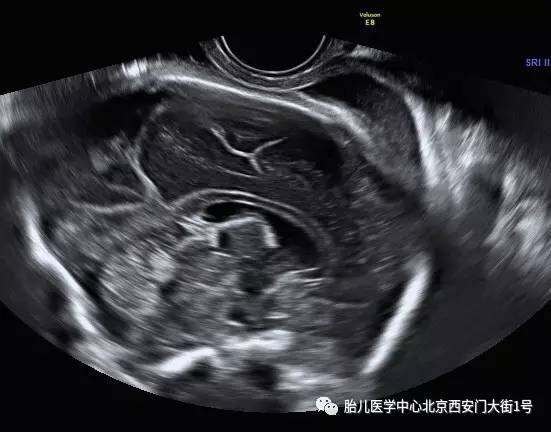 暂无
