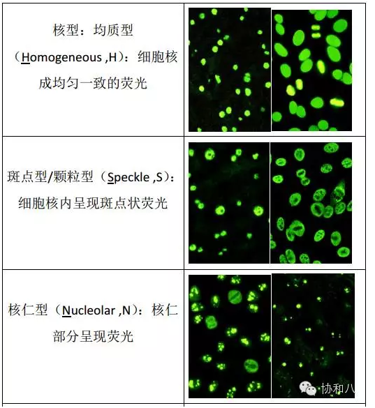 皮肤科风湿免疫科常见化验结果解读 - 好大夫在线