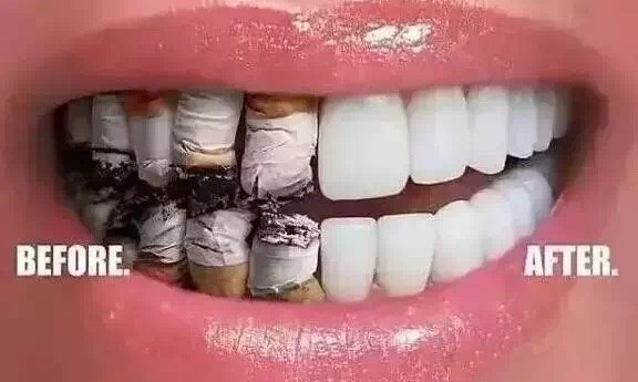吸烟对种植牙有什么影响?