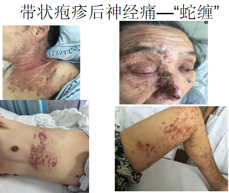 疼痛科最擅长看啥病