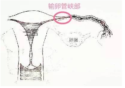 输卵管分段图片