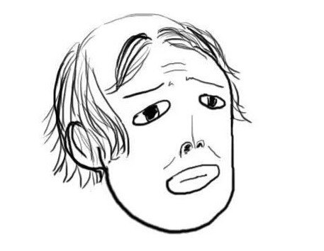 植发手术术后多久能够去见人?