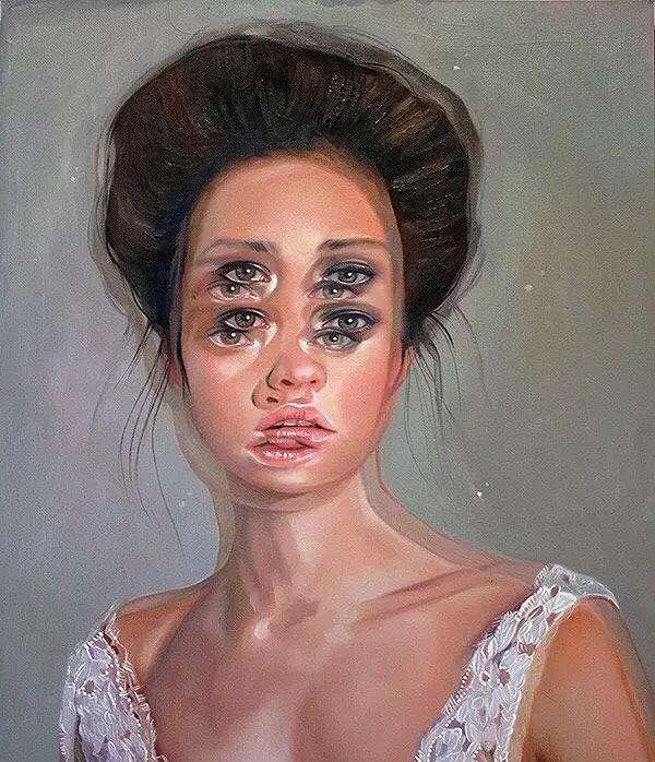 遭受人为(转体和半规管功能检查)或病变损伤所引起的一侧兴奋性增高