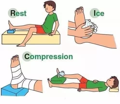 图5 踝关节扭伤的rice原则示意图.jpeg