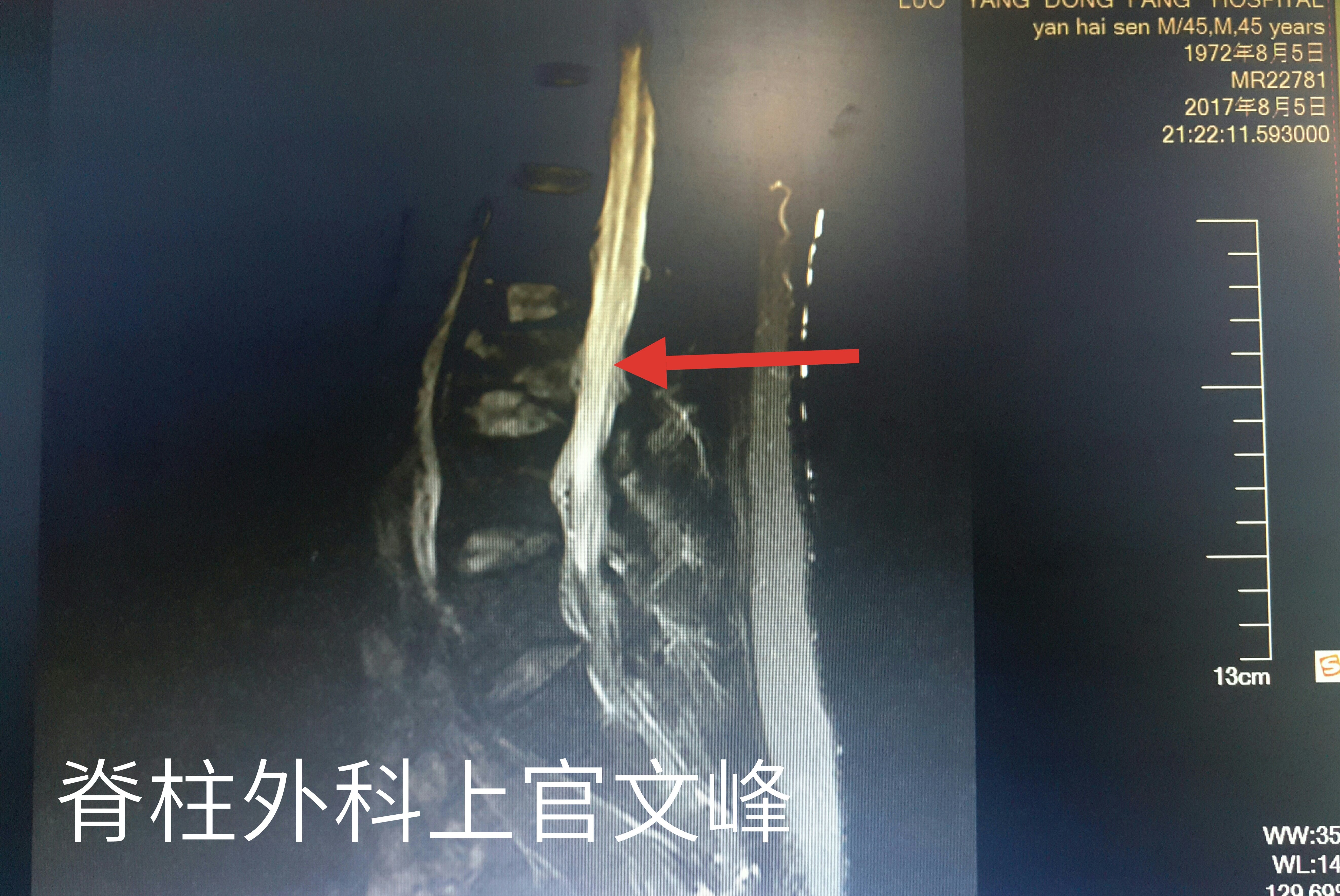 暂无