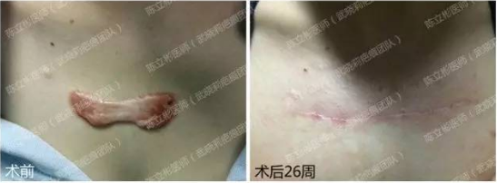1505040845809721.png 图片.png