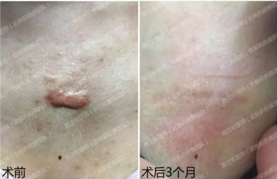 1505040838221977.png 图片.png