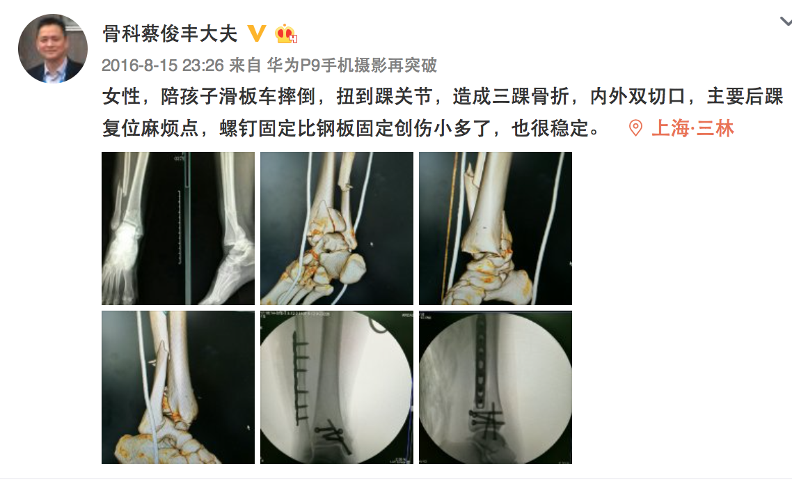 骨科常见病典型病例分享