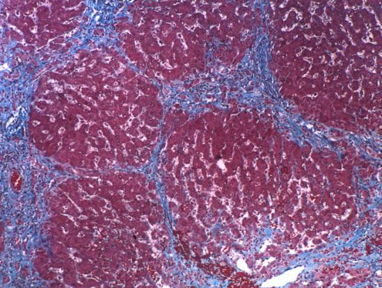 *图中红色为肝脏细胞,蓝色网状结构为纤维组织