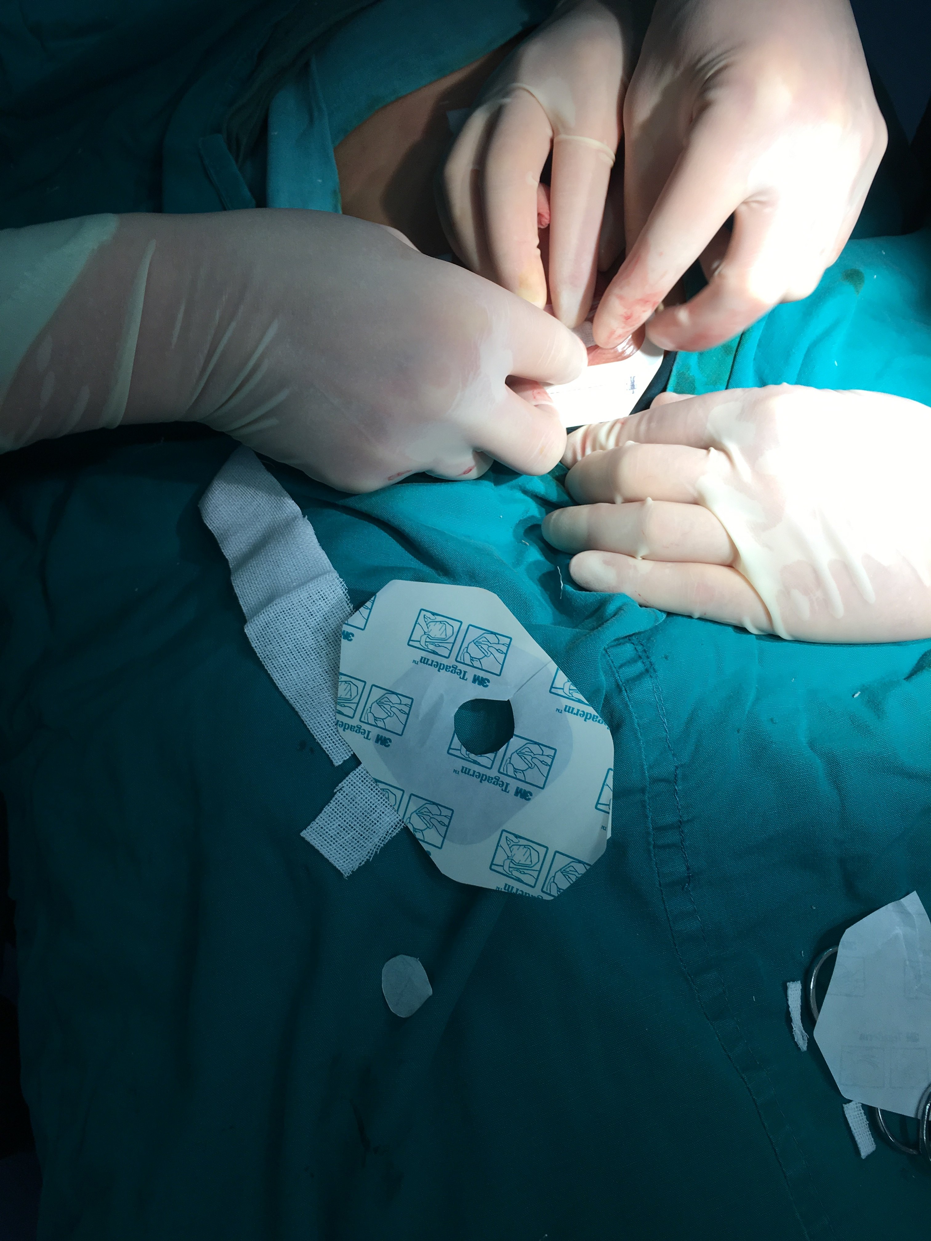 包含原武警总医院代诊挂号服务术后伤口换药、复查全程陪同的词条 包含原武警总医院代诊挂号服务术后伤口换药、复查全程陪同的词条