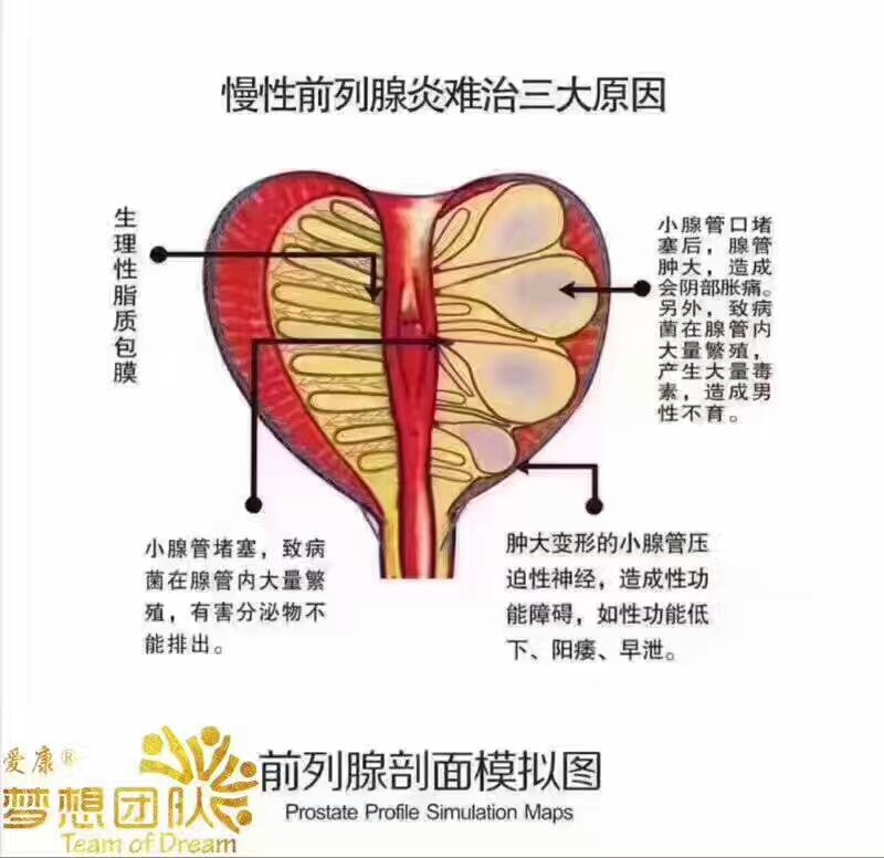 正确认识前列腺结构 - 好大夫在线