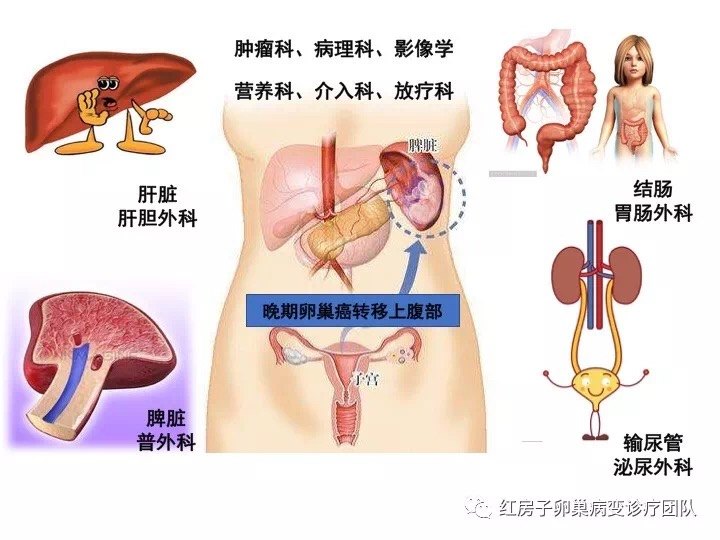 多学科诊治 挂一个号看多名专家 多学科诊治 挂一个号看多名专家
