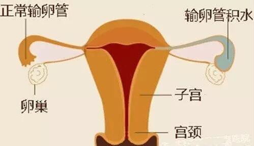 3,输卵管妊娠的发生2,手术破坏了体内解剖结果及内环境1,卵巢供应血管