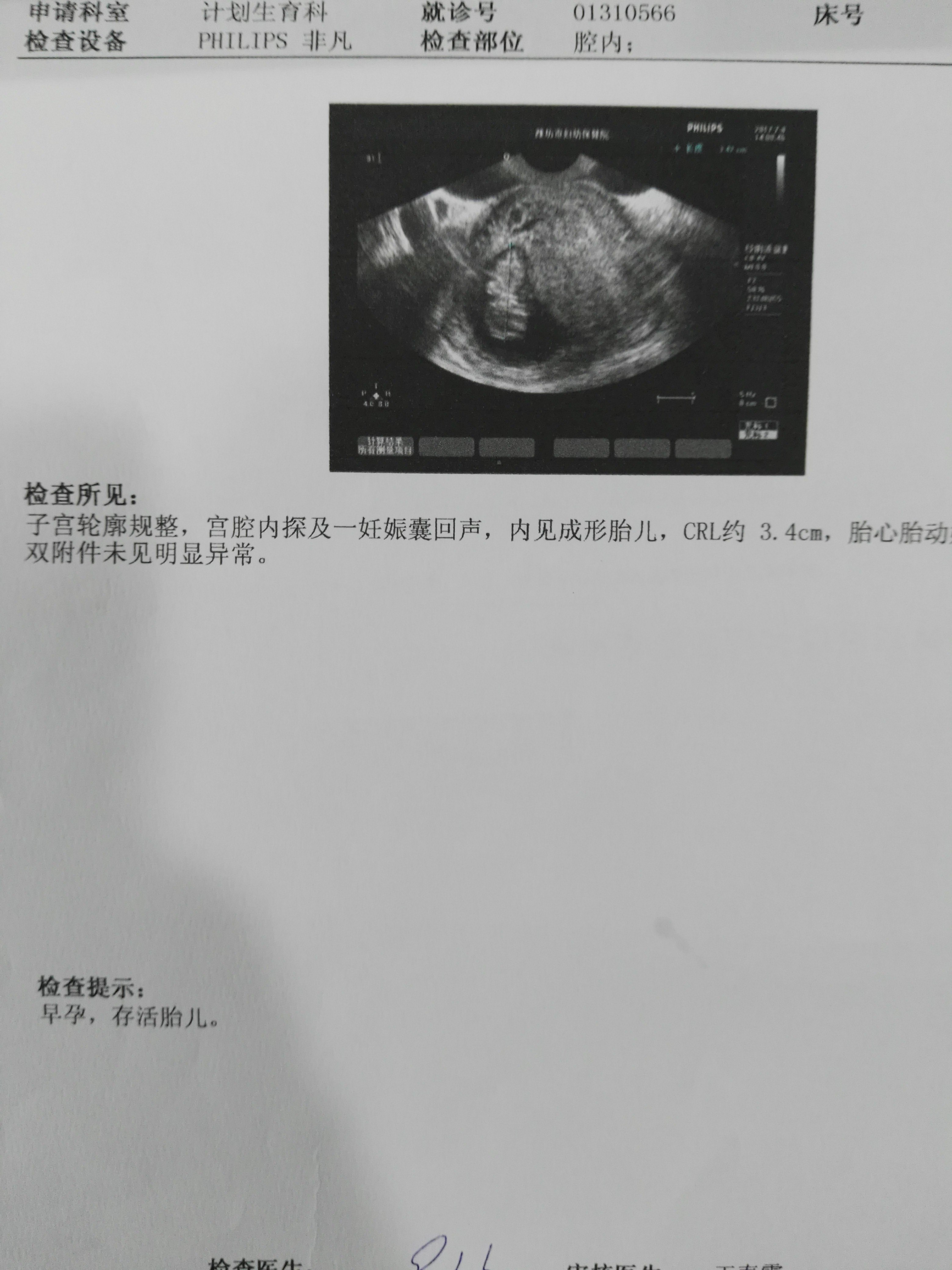 教你学会自己看妇科彩超报告单