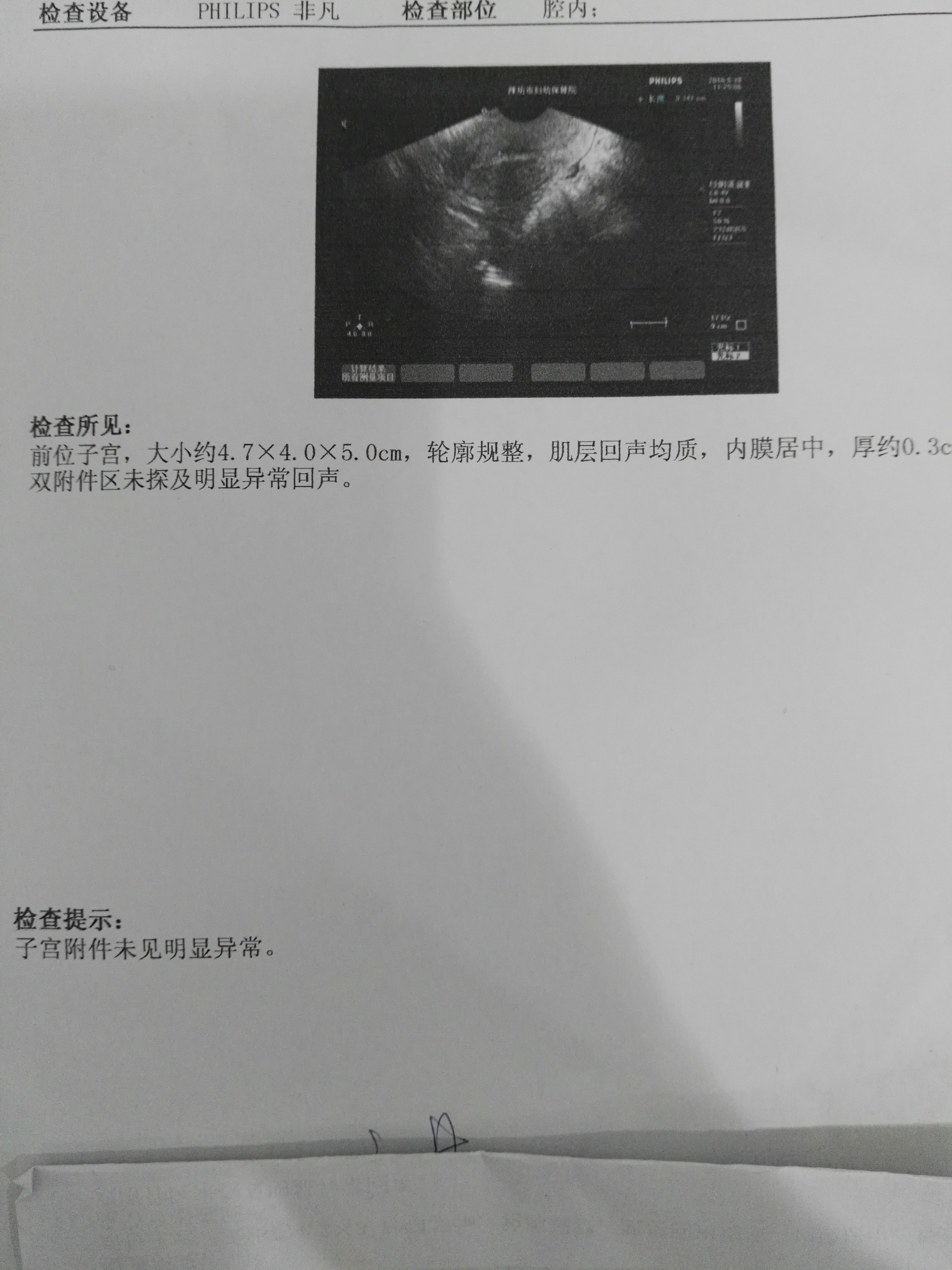教你学会自己看妇科彩超报告单