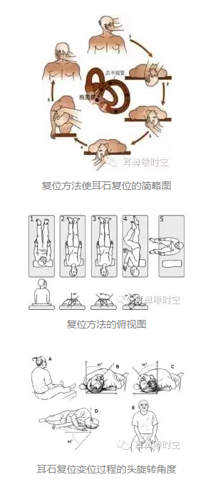 耳石症手法復位