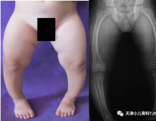 1505789238540126.png 图片.png