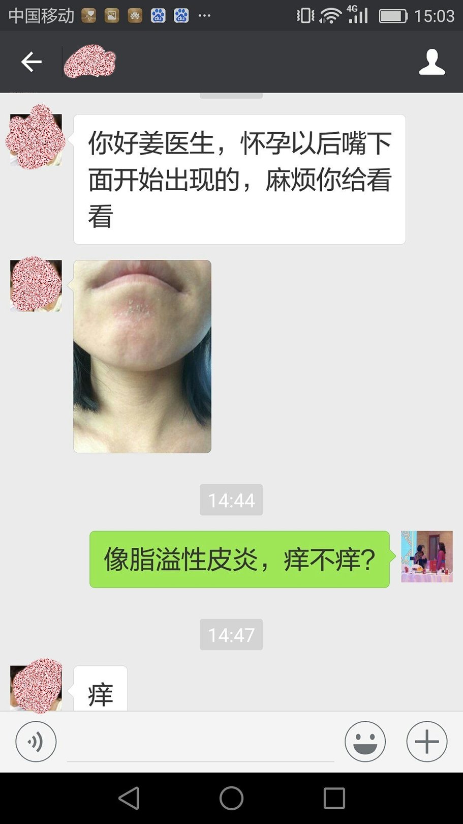 脂溢性皮炎自愈大概需要多久的简单介绍