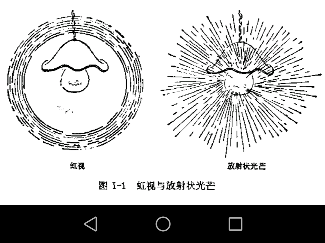 眼科常见症状之 虹视 眼部疾病 疾病介绍 眼科常见症状之 虹视 眼部疾病 疾病介绍