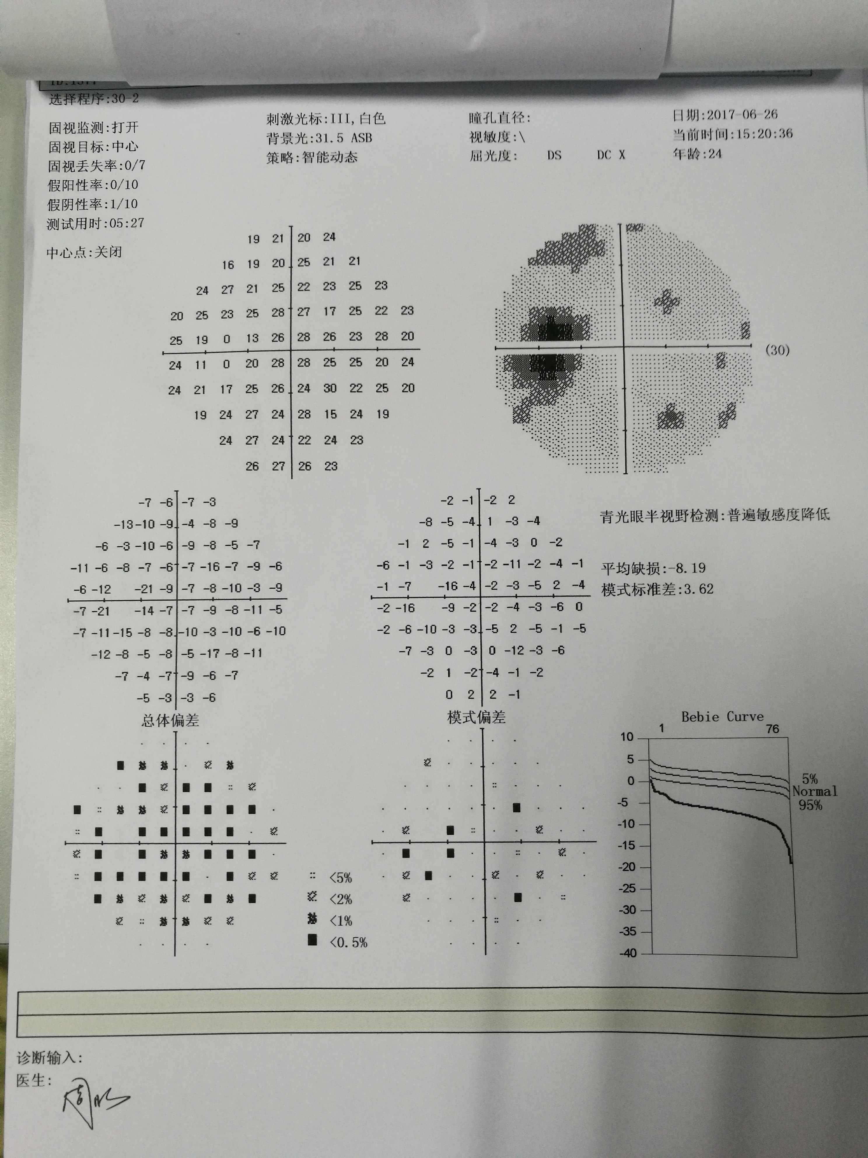 从上海华山医院转过来的一例特发性颅内高压的变化过程