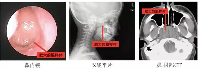 1501334963731097.png 4.png